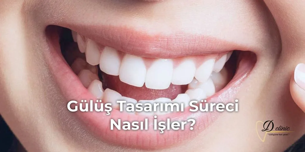 gulus-tasarimi-sureci-nasil-isler-min