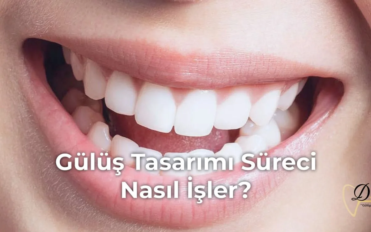 gulus-tasarimi-sureci-nasil-isler-min